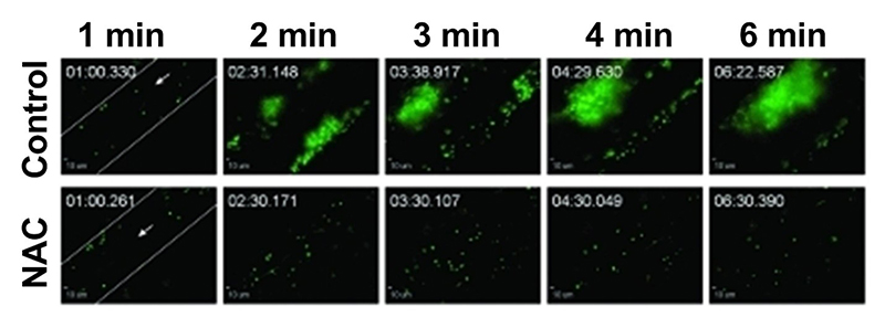 VWF-mediated platelet (green) thrombus accumulation in ADAMTS13 deficient mice with and without N-acetylcysteine (NAC) treatment.